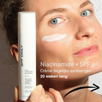 Vervaag je pigmentlvlekken met deze crème of je geld terug [crème + maskers + verzending]
