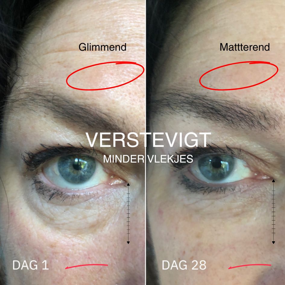 Deze SPF-crème is het enige wat werkt tegen huidveroudering